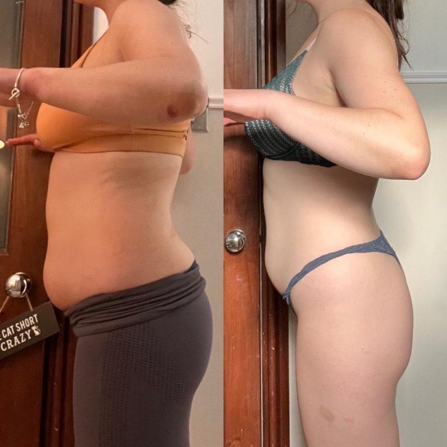 Emma — before and after transformation photos, postpartum fat loss, -10kg